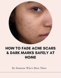 How To Fade Acne Scars & Dark Marks Safely At Home Guide