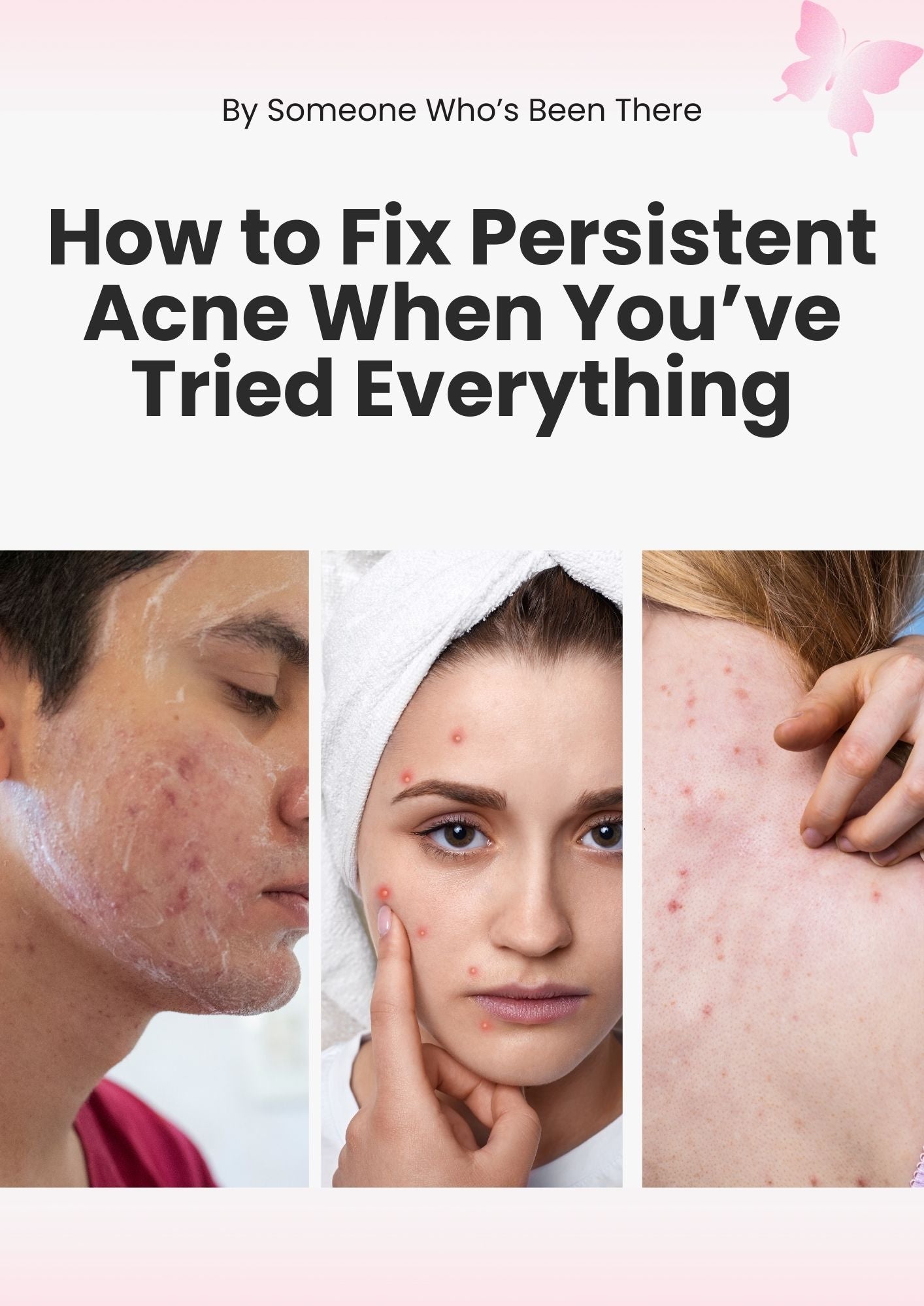 How to Fix Persistent Acne When You’ve Tried Everything Guide